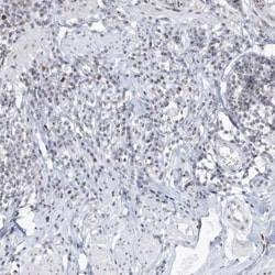 DDX21 Antibody, Novus Biologicals 0.1mL; Unlabeled:Antibodies, Polyclonal