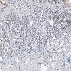 DDX21 Antibody, Novus Biologicals 0.1mL; Unlabeled:Antibodies, Polyclonal