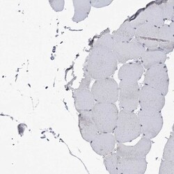 DDX21 Antibody, Novus Biologicals 0.1mL; Unlabeled:Antibodies, Polyclonal