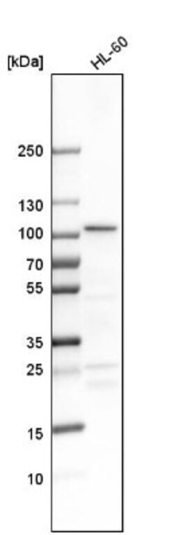 DDX21 Antibody, Novus Biologicals 0.1mL; Unlabeled:Antibodies, Polyclonal
