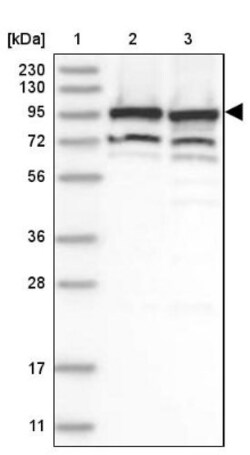 DDX21 Antibody, Novus Biologicals 0.1mL; Unlabeled:Antibodies, Polyclonal