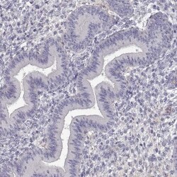 DDX25 Antibody, Novus Biologicals 25 &mu;L; Unlabeled:Antibodies, Polyclonal