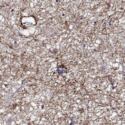 DDX25 Antibody, Novus Biologicals 25 &mu;L; Unlabeled:Antibodies, Polyclonal