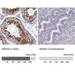 DDX25 Antibody, Novus Biologicals 25 &mu;L; Unlabeled:Antibodies, Polyclonal