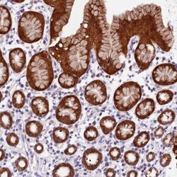 DDX28 Antibody, Novus Biologicals:Antibodies:Primary Antibodies