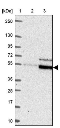 DDX28 Antibody, Novus Biologicals:Antibodies:Primary Antibodies