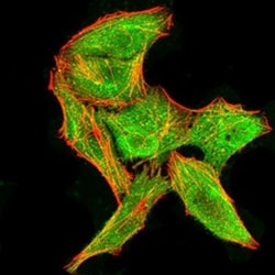 DDX3 Antibody (3B9E3) - BSA Free, Novus Biologicals 0.1mg; Unlabeled:Antibodies,