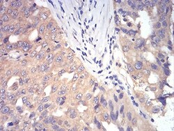 DDX3 Antibody (3B9E3) - BSA Free, Novus Biologicals 0.1mg; Unlabeled:Antibodies,