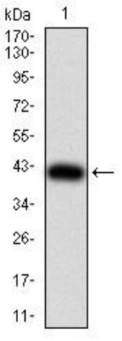 DDX3 Antibody (3B9E3) - BSA Free, Novus Biologicals 0.1mg; Unlabeled:Antibodies,