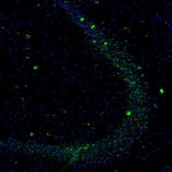 DDX3 Antibody, Novus Biologicals 0.1mL; Unlabeled:Antibodies, Polyclonal