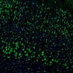 DDX3 Antibody, Novus Biologicals 0.1mL; Unlabeled:Antibodies, Polyclonal