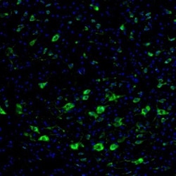 DDX3 Antibody, Novus Biologicals 0.1mL; Unlabeled:Antibodies, Polyclonal