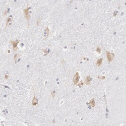 DDX3 Antibody, Novus Biologicals 0.1mL; Unlabeled:Antibodies, Polyclonal