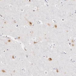 DDX3 Antibody, Novus Biologicals 0.1mL; Unlabeled:Antibodies, Polyclonal