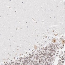 DDX3 Antibody, Novus Biologicals 0.1mL; Unlabeled:Antibodies, Polyclonal