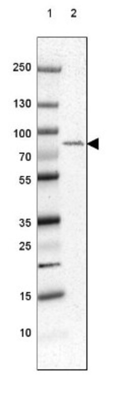 DDX3 Antibody, Novus Biologicals 0.1mL; Unlabeled:Antibodies, Polyclonal