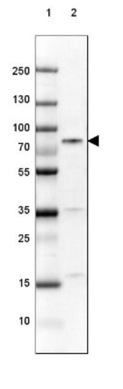 DDX3 Antibody, Novus Biologicals 0.1mL; Unlabeled:Antibodies, Polyclonal