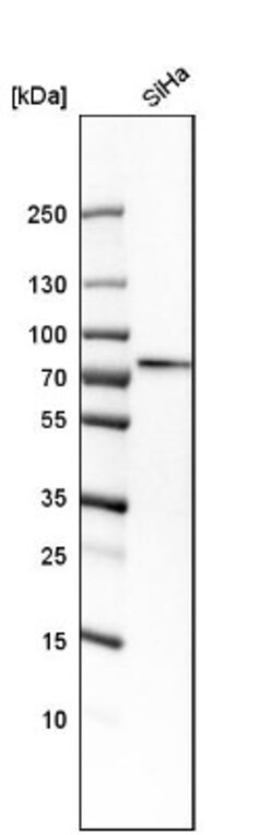 DDX3 Antibody, Novus Biologicals 0.1mL; Unlabeled:Antibodies, Polyclonal