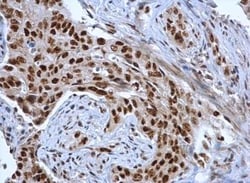 DDX39 Antibody, Novus Biologicals 0.1mL; Unlabeled:Antibodies, Polyclonal