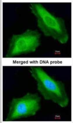 DDX3 Antibody, Novus Biologicals 0.1mL; Unlabeled:Antibodies, Polyclonal