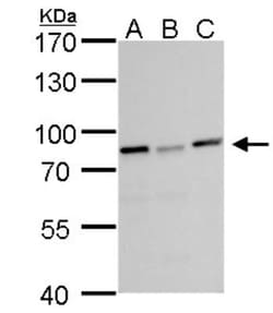 DDX3 Antibody, Novus Biologicals 0.1mL; Unlabeled:Antibodies, Polyclonal