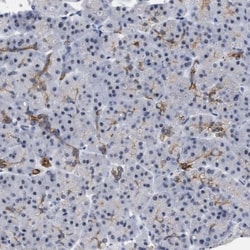DDX41 Antibody, Novus Biologicals 0.1mL; Unlabeled:Antibodies, Polyclonal