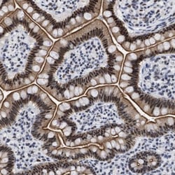 DDX41 Antibody, Novus Biologicals 0.1mL; Unlabeled:Antibodies, Polyclonal