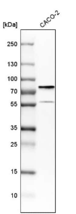 DDX41 Antibody, Novus Biologicals 0.1mL; Unlabeled:Antibodies, Polyclonal