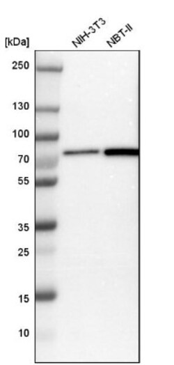 DDX41 Antibody, Novus Biologicals 0.1mL; Unlabeled:Antibodies, Polyclonal