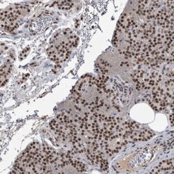 DDX42 Antibody, Novus Biologicals:Antibodies:Primary Antibodies