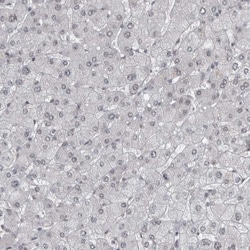 DDX42 Antibody, Novus Biologicals:Antibodies:Primary Antibodies