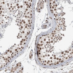 DDX42 Antibody, Novus Biologicals:Antibodies:Primary Antibodies