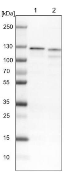 DDX42 Antibody, Novus Biologicals:Antibodies:Primary Antibodies