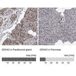 DDX42 Antibody, Novus Biologicals:Antibodies:Primary Antibodies
