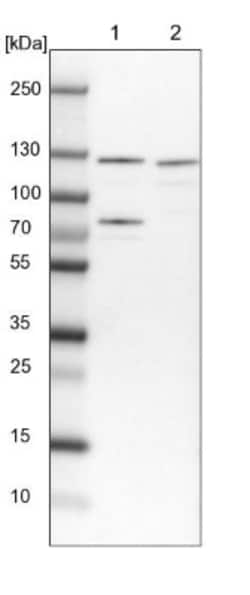 DDX42 Antibody, Novus Biologicals:Antibodies:Primary Antibodies