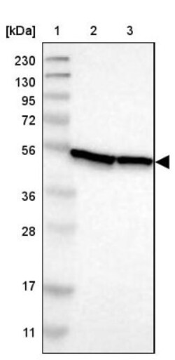 DDX47 Antibody, Novus Biologicals 0.1mL; Unlabeled:Antibodies, Polyclonal