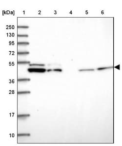 DDX49 Antibody, Novus Biologicals 25 &mu;L; Unlabeled:Antibodies, Polyclonal