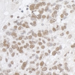 DDX5 Antibody, Novus Biologicals 0.1mL; Unlabeled:Antibodies, Polyclonal