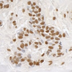 DDX5 Antibody, Novus Biologicals 0.1mL; Unlabeled:Antibodies, Polyclonal