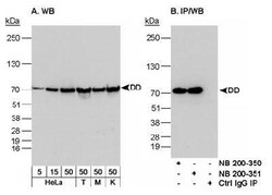 DDX5 Antibody, Novus Biologicals 0.1mL; Unlabeled:Antibodies, Polyclonal