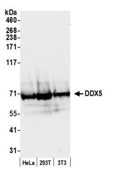 DDX5 Antibody, Novus Biologicals 0.1mL; Unlabeled:Antibodies, Polyclonal
