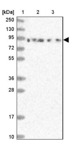DDX51 Antibody, Novus Biologicals 0.1mL; Unlabeled:Antibodies, Polyclonal
