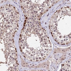 DDX55 Antibody, Novus Biologicals:Antibodies:Primary Antibodies