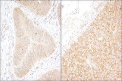 DDX6 Antibody, Novus Biologicals 0.1mL; Unlabeled:Antibodies, Polyclonal