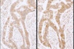 DDX6 Antibody, Novus Biologicals 100µL | Buy Online | Novus Biologicals | Fisher Scientific
