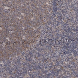 DDX6 Antibody, Novus Biologicals 0.1mL; Unlabeled:Antikroppar