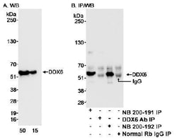 DDX6 Antibody, Novus Biologicals 100µL | Buy Online | Novus Biologicals | Fisher Scientific