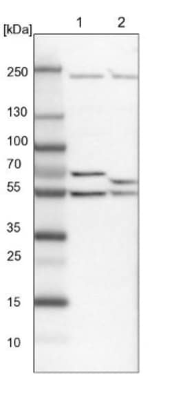 DDX6 Antibody, Novus Biologicals:Antibodies:Primary Antibodies