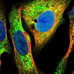 DECR1 Antibody, Novus Biologicals:Antibodies:Primary Antibodies