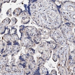 DECR1 Antibody, Novus Biologicals:Antibodies:Primary Antibodies
